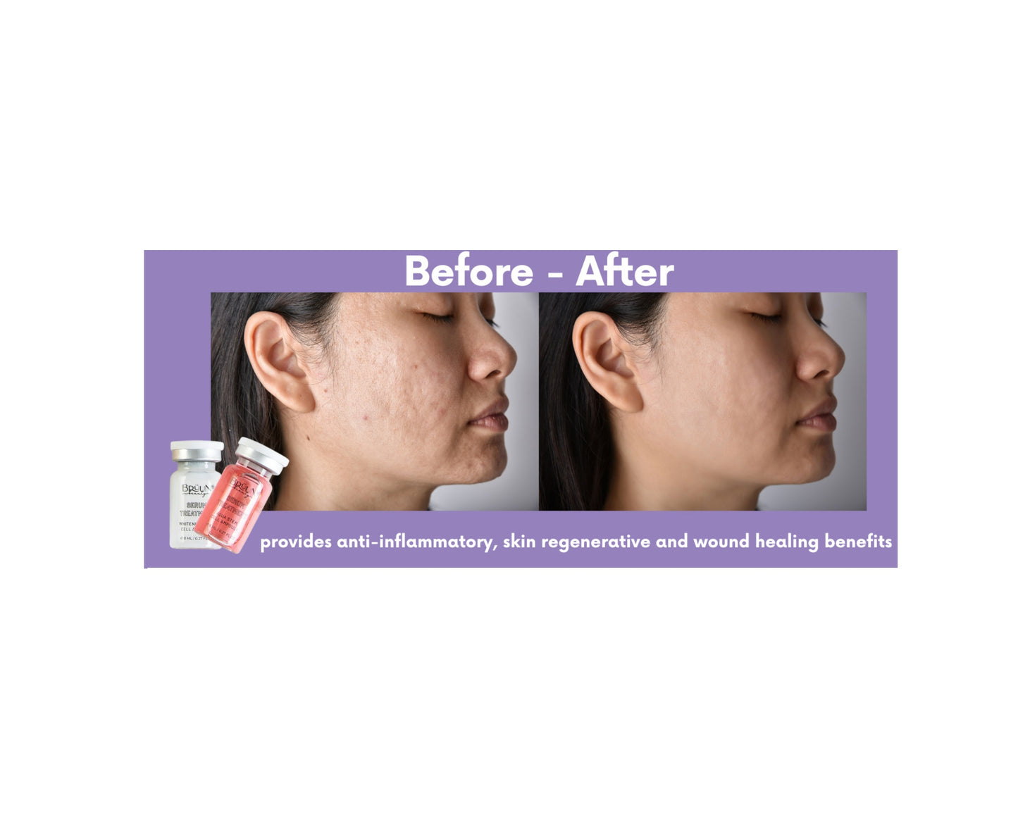 Kit de reforço de cuidados com a pele para uso com Derma Pen Resultados duradouros