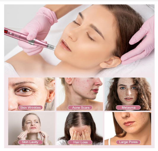 Derma Pen Avec écran LCD et Microneedling 12 Cartouches